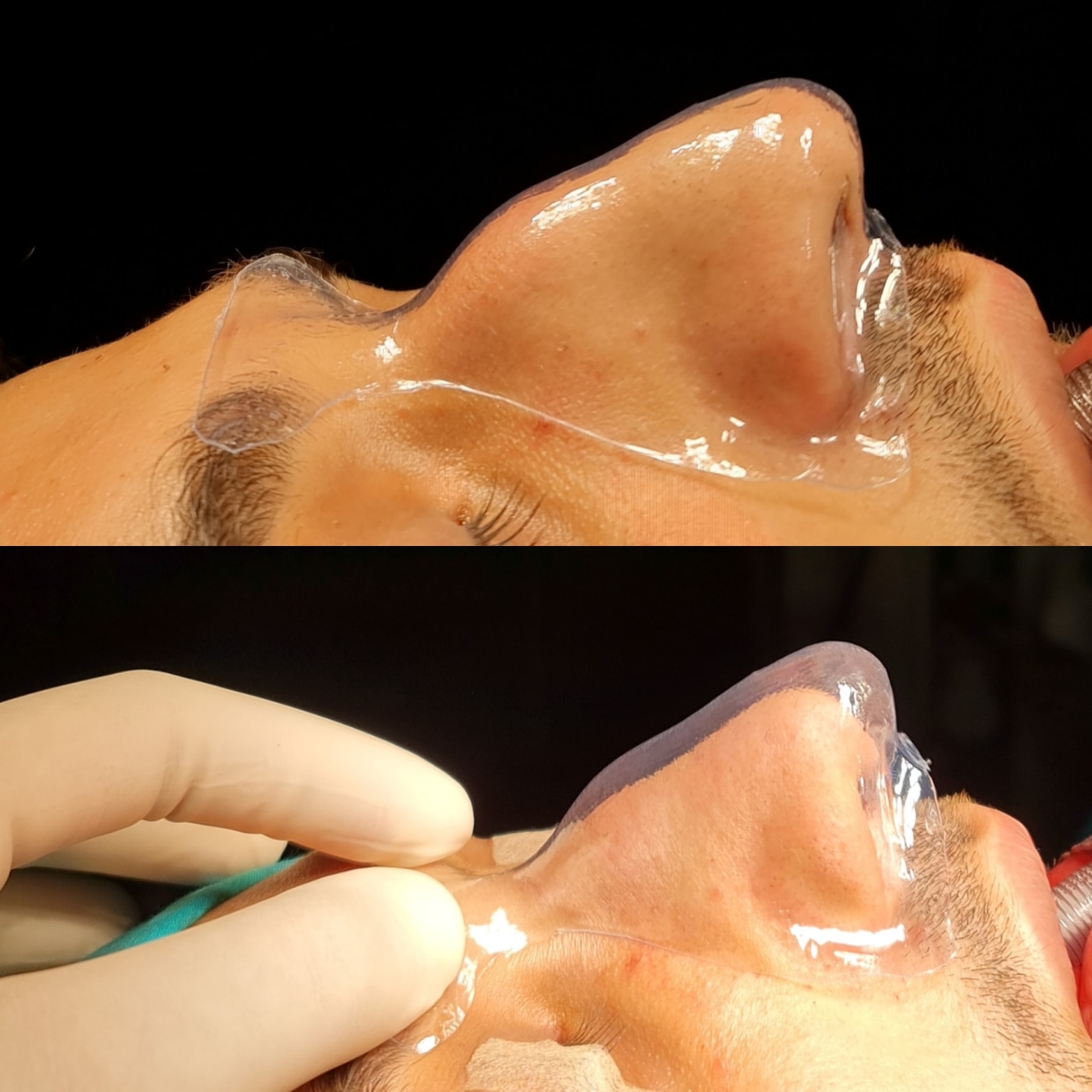 3D baskı burun modelleri
