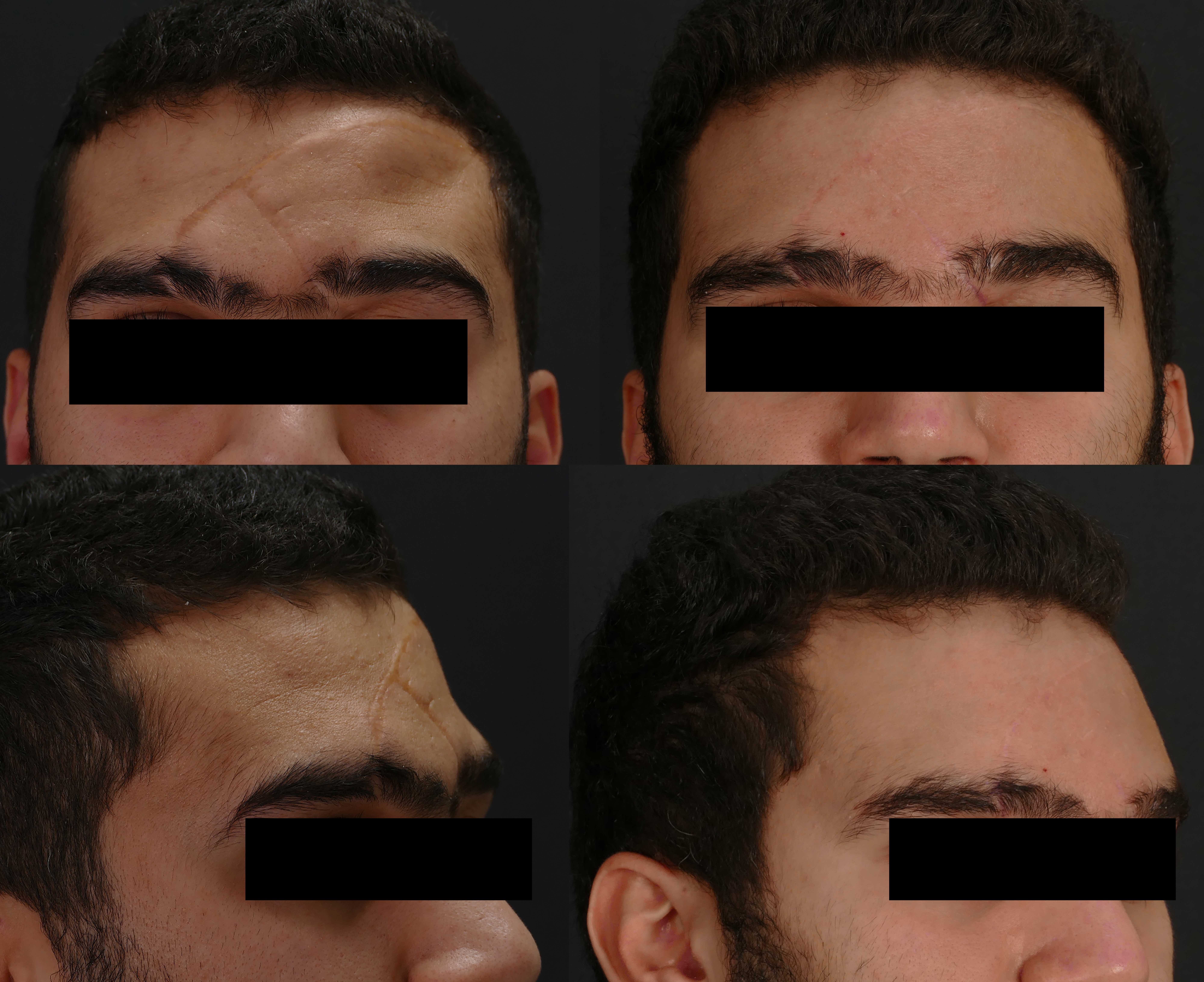 إعادة بناء الجبهة